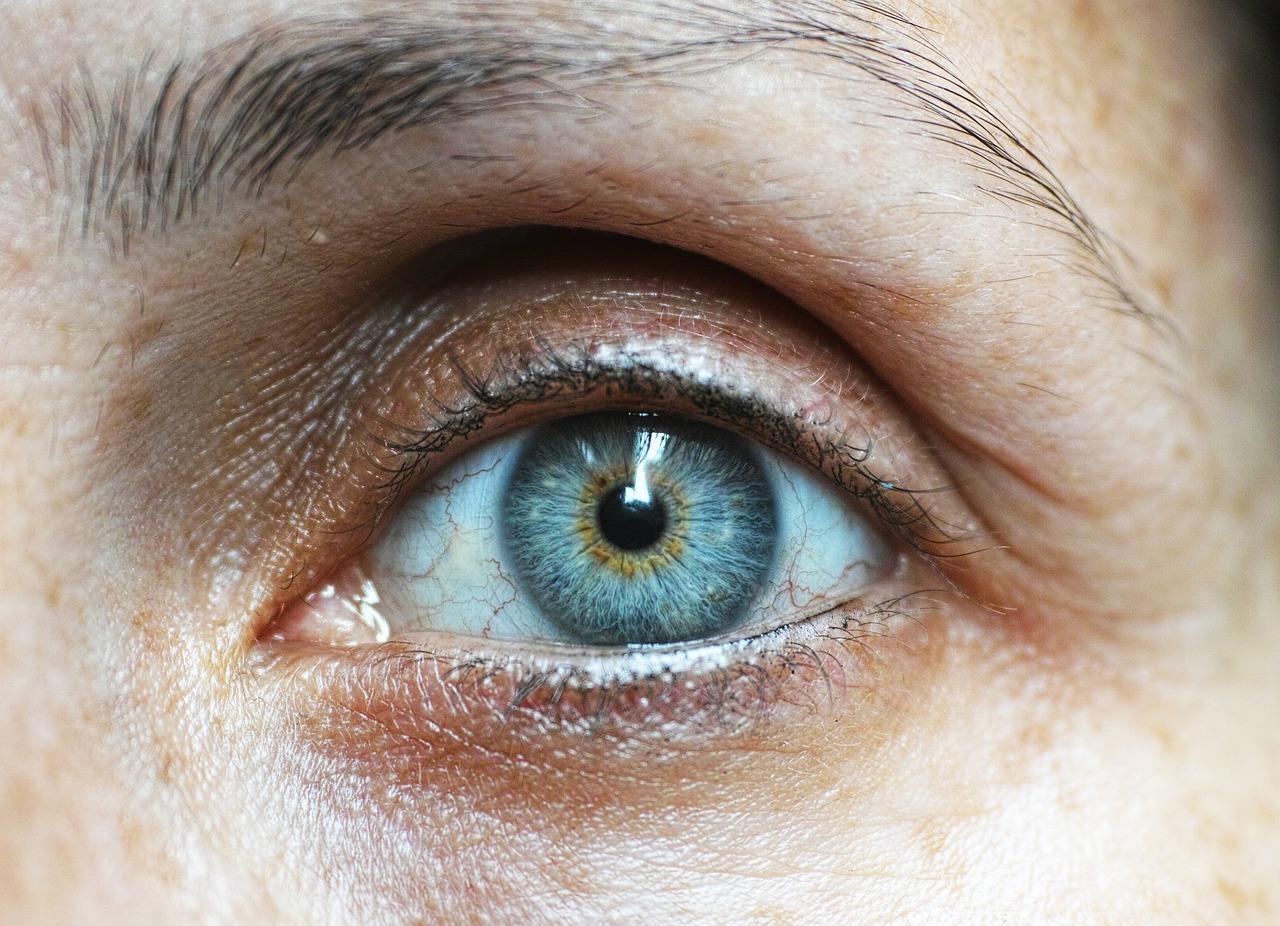 علاج انتفاخات العين والاجهاد